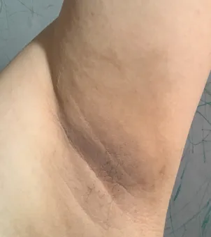 Progress