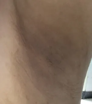 Progress