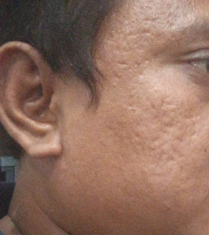 Progress