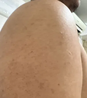 Progress