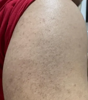 Progress