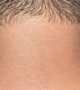 Progress