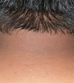 Progress